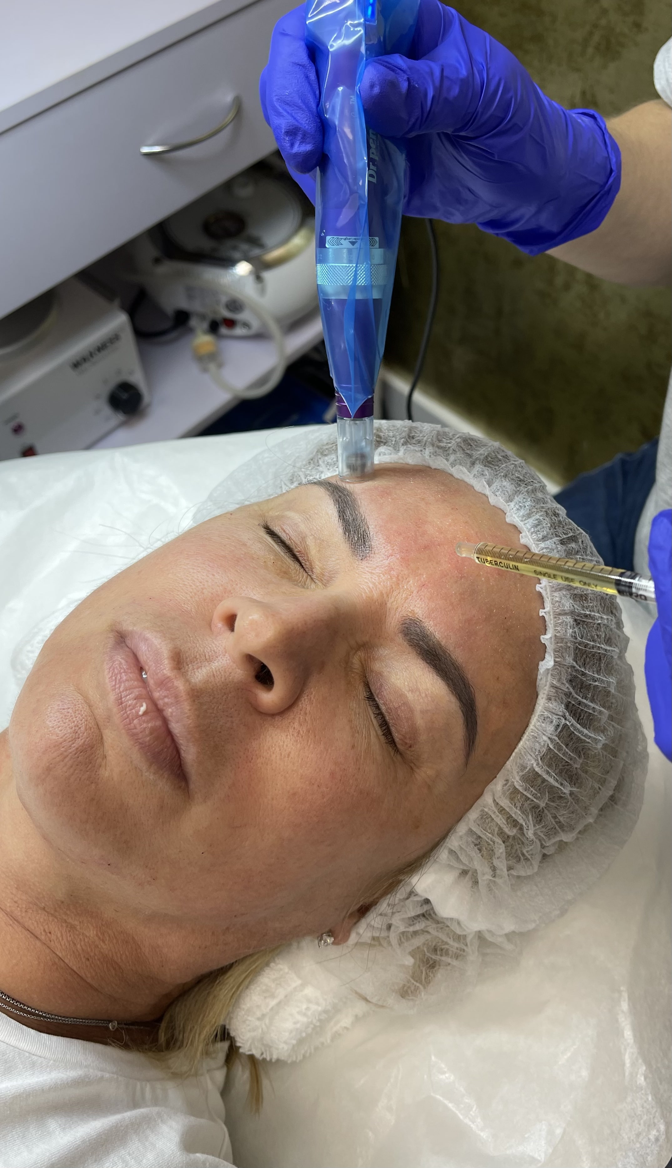 A face receiving plasma treatment